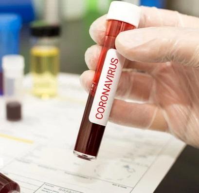 کرونا همچنان می تازد، 65 بیمار جدید در دام کرونا ویروس